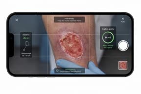 Guided wound capture