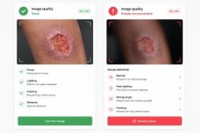 Image quality control